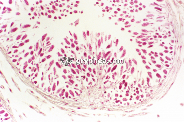 Fucus - anthéridies dans un conceptacle mâle x70 - gryphea.com